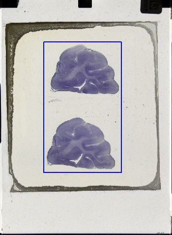 Media type: image; Special Collections 3043   shows specimen_part histological serial section;